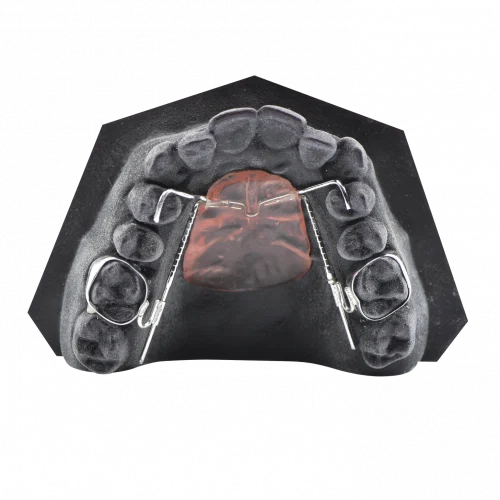 Inman Distalizer Mask