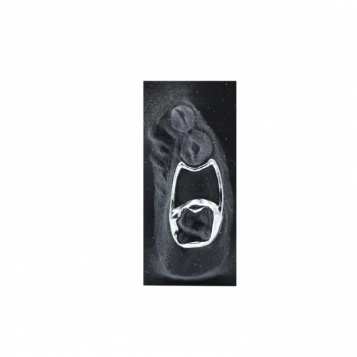 Unilateral Space Maintainer Mask